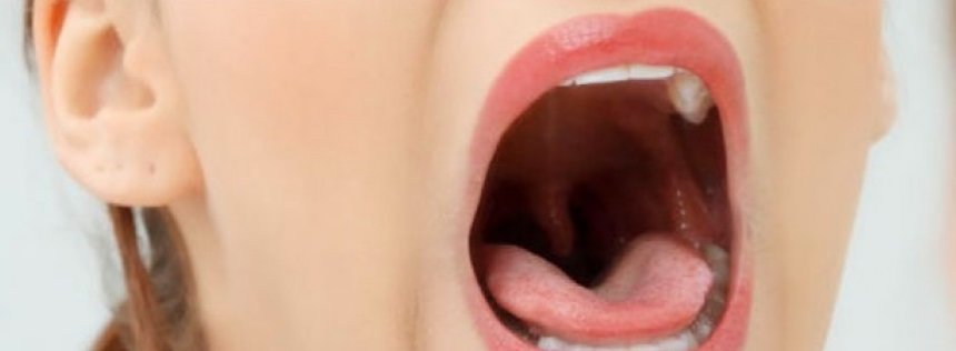 Realizarán una campaña de detección del Cáncer Bucal | 